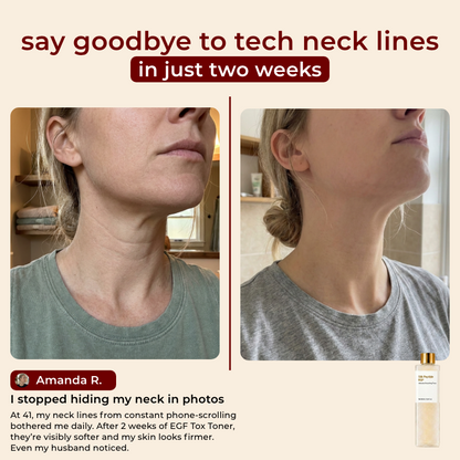 EGF Tox Toner
